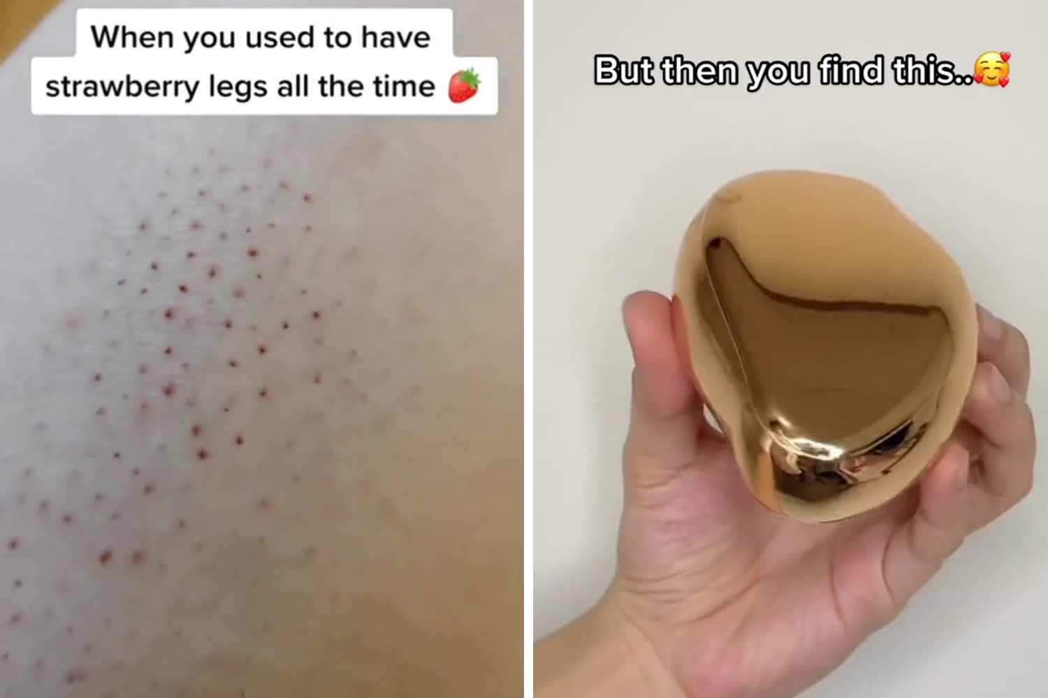Beauty fans go crazy for a painless hair eraser that gets rid of strawberry legs